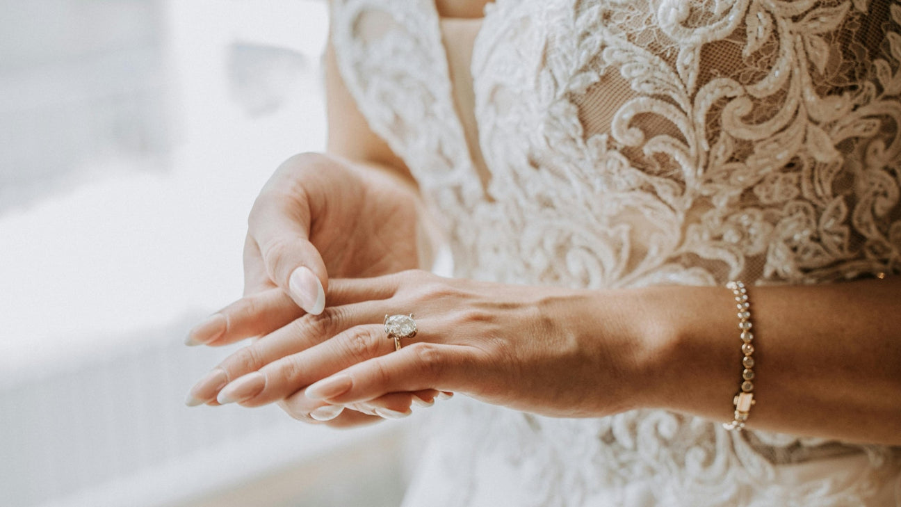 Should Rings Be Tight or Loose? Finding the Perfect Fit